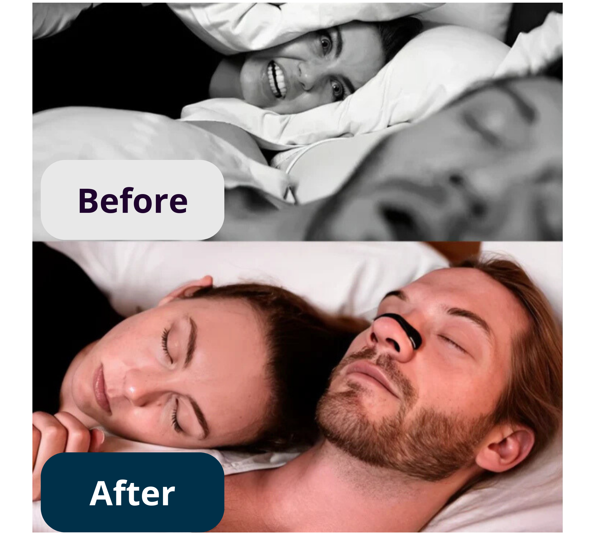 Snoreze⎜Magnetic Anti-Snoring