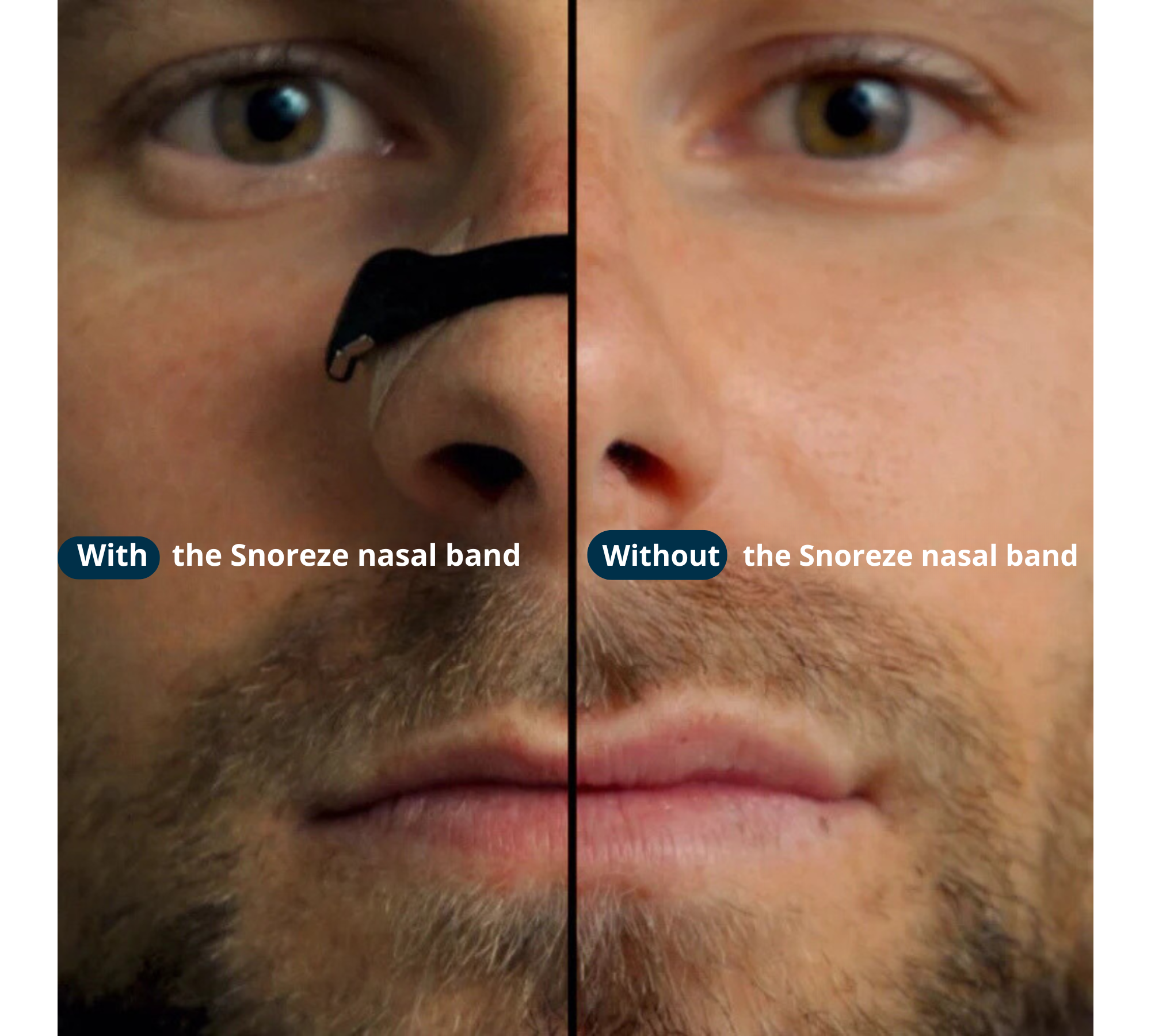 Snoreze⎜Magnetic Anti-Snoring